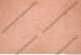 Photo Textures of Human Skin
